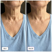 SKIN BALSAMO - El Secreto Coreano 5 en 1: Piel Luminosa y Firme - Desde el día 1