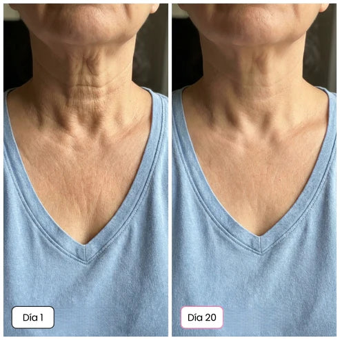 SKIN BALSAMO - El Secreto Coreano 5 en 1: Piel Luminosa y Firme - Desde el día 1