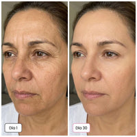 SKIN BALSAMO - El Secreto Coreano 5 en 1: Piel Luminosa y Firme - Desde el día 1