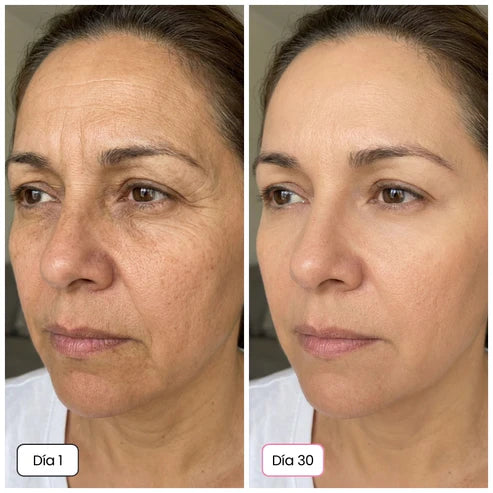 SKIN BALSAMO - El Secreto Coreano 5 en 1: Piel Luminosa y Firme - Desde el día 1