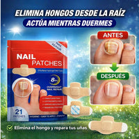 NailReset™ Parche Antifúngico para Hongo