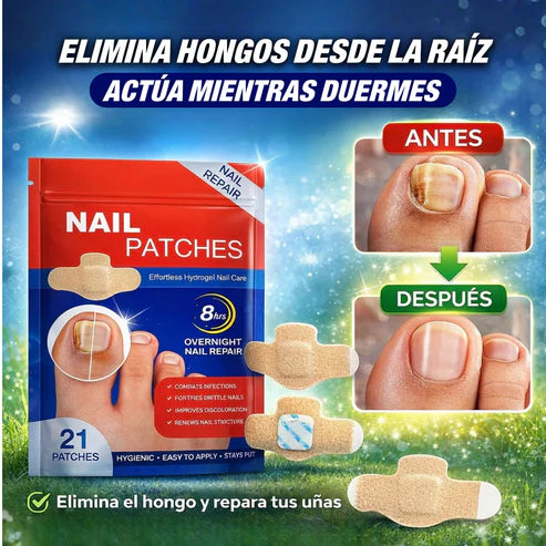NailReset™ Parche Antifúngico para Hongo